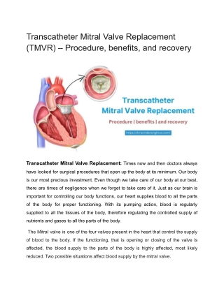 Transcatheter Mitral Valve Replacement (TMVR)