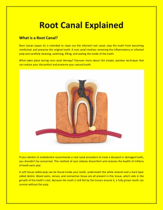 Root Canal Explained