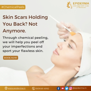 Is Skin Scars Holding You Back | Dermatologist in Jayanagar | Epiderma Clinic