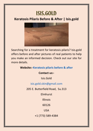 Keratosis Pilaris Before & After | Isis.gold