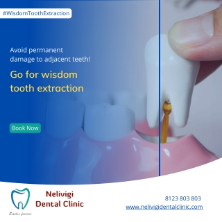 Avoid permanent damage to adjacent teeth - Dentist Bellandur - Nelivigi Dental