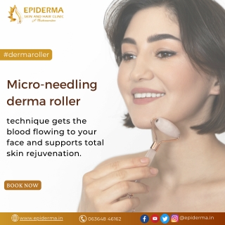 Micro needling derma roller | Best Skin Clinic in Jayanagar | Epiderma Clinic