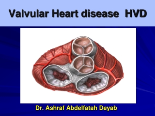 Valvular Heart disease HVD