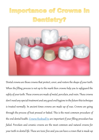 Importance of Crowns in Dentistry