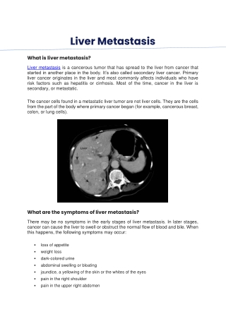 Liver Metastasis