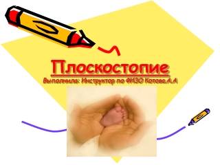 Плоскостопие