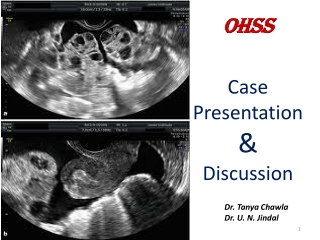 OHSS Case Presentation & Discussion | Jindal IVF Chandigarh