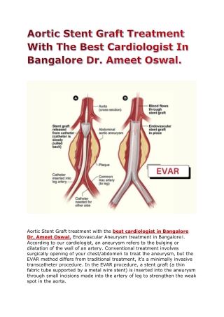 Aortic Stent Graft treatment with the best cardiologist in Bangalore Dr. Ameet Oswal details