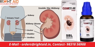 RENAL COLIC & URINARY COMPLAINTS REPORT CLEARSTONE DROPS SBL  RightAid