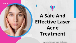 A Safe And Effective Laser Acne Treatment