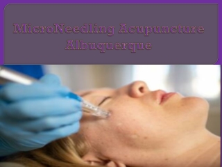 MicroNeedling Acupuncture Albuquerque