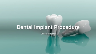 Dental Implant Procedure