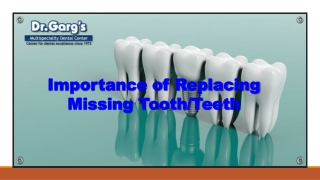 Importance of Replacing Missing Tooth Teeth