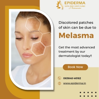 Discolored patches of skin | Dermatology Centre in Jayanagar | Epiderma Clinic