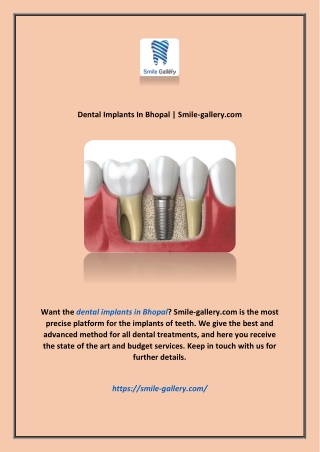 Dental Implants In Bhopal | Smile-gallery.com