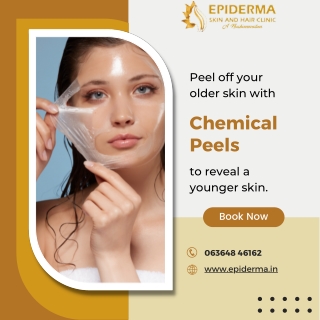 Chemical Peels - Best Skin Clinic in Jayanagar, Bangalore - Epiderma Clinic