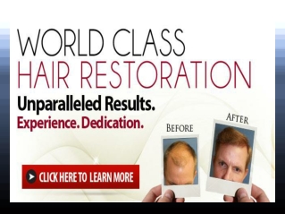 Hair Loss Restoration Products