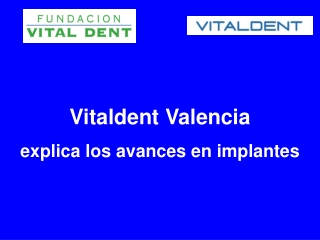 Vitaldent Valencia explica los avances en implantes