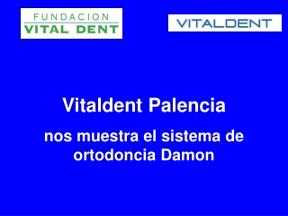 Vitaldent Palencia nos muestra la ortodoncia Damon