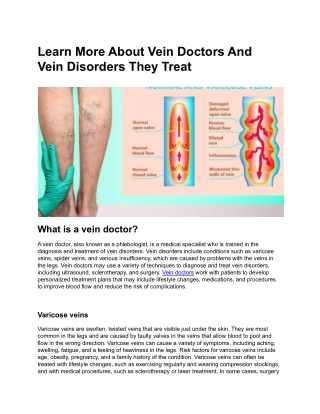 Learn More About Vein Doctors And Vein Disorders They Treat