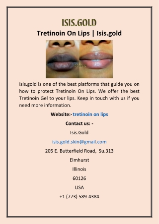 Tretinoin On Lips | Isis.gold