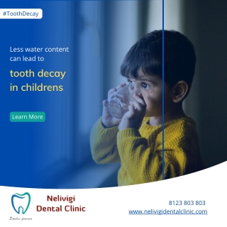 Tooth Decay in childrens | Best Dental Clinic in Bellandur | Nelivigi Dental