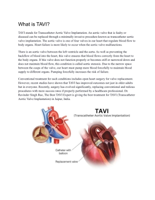 Transcatheter Aortic Valve Implantation (TAVI) - Dr. Ravinder Singh Rao