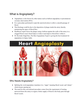 Angioplasty in India - Dr. Ravinder Singh Rao