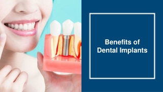 Benefits of Dental Implants - Nuface Dental Implant