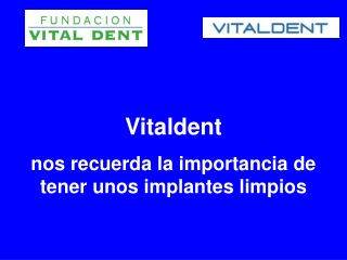 Vitaldent y la importancia de tener los implantes limpios