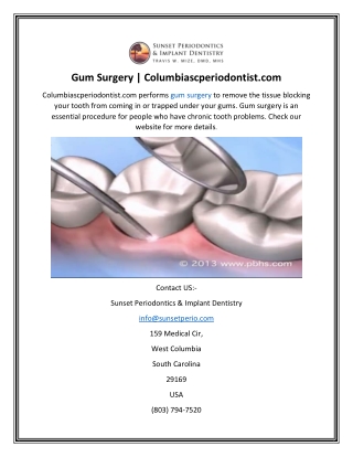 Gum Surgery  Columbiascperiodontist.com