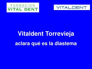 Vitaldent Torrevieja aclara que es la diastema