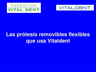 Las protesis removibles flexibles que usa Vitaldent