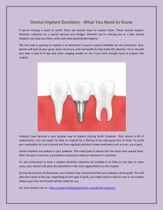 Dental Implant Dentistry - What You Need to Know