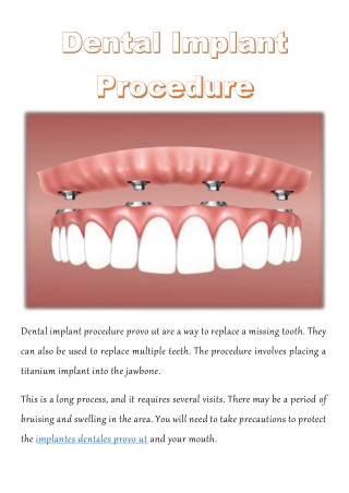 Dental Implant Procedure