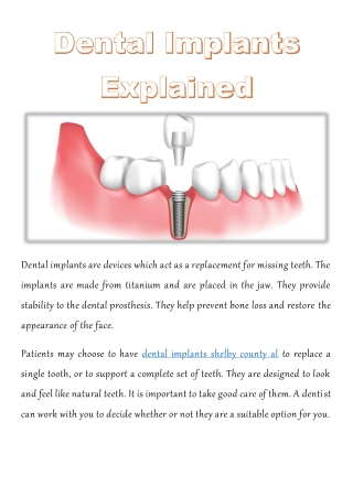 Dental Implants Explained