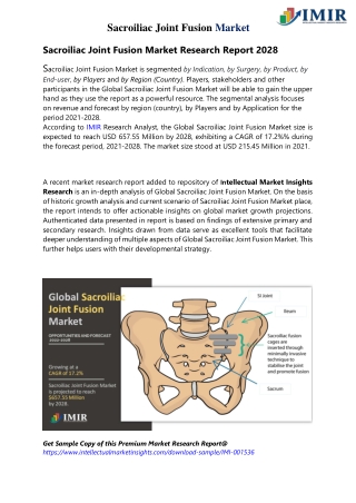 With 17.2% CAGR, Sacroiliac Joint Fusion Market Size Likely to Hit $657.55 Mn
