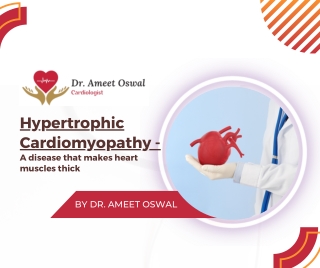 Hypertrophic Cardiomyopathy A disease that makes heart muscles thick With the best cardiologist in Bangalore Dr. Ameet O