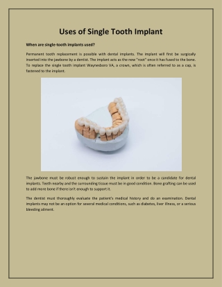 Uses of Single Tooth Implant