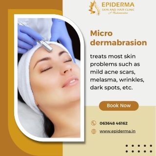 Microdermabrasion | Best Dermatologist in Jayanagar, Bangalore | Epiderma Clinic