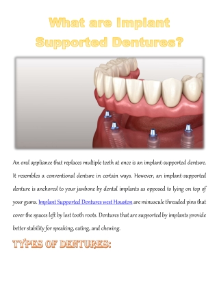 What are Implant Supported Dentures