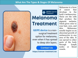 What Are The Types & Stages Of Melanoma