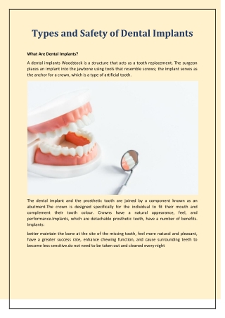 Types and Safety of Dental Implants