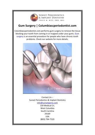 Gum Surgery  Columbiascperiodontist.com