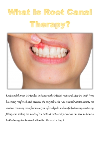 What Is Root Canal Therapy