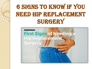 6 Signs to Know If You Need Hip Replacement Surgery