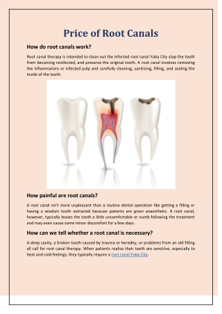 Price of Root Canals