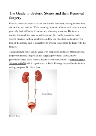 The Guide to Ureteric Stones and their Removal Surgery