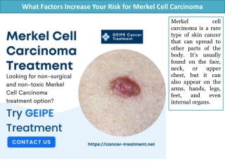 What Factors Increase Your Risk for Merkel Cell Carcinoma?