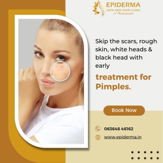 Get the advanced treatment for Pimples | Epiderma Skin Clinic in Jayanagar